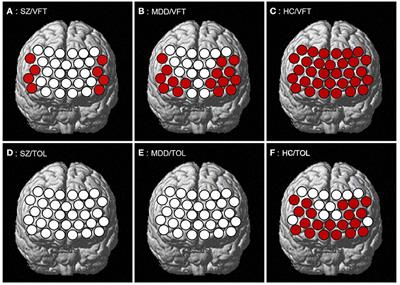 Prefrontal Cortex Activation During Verbal Fluency Task and Tower of London Task in Schizophrenia and Major Depressive Disorder